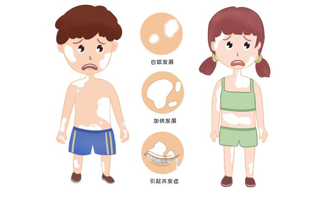 南阳白癜风医院5月排名-患者如何做好白癜风日常的防护?(图1)